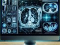 AI医学影像如何赋能精准诊断？