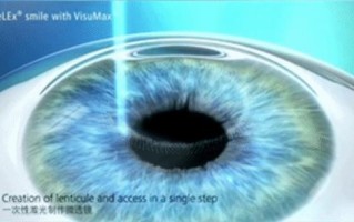 Alpha机器人眼睛灯为何不亮？