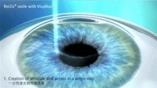 Alpha机器人眼睛灯为何不亮？-第1张图片-广州国自机器人