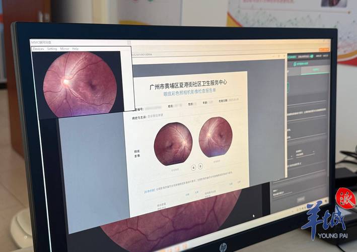 人工智能如何辅助而非主导疾病诊断？-第2张图片-广州国自机器人