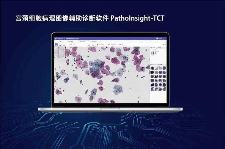 AI如何革新病理切片制片？-第2张图片-广州国自机器人
