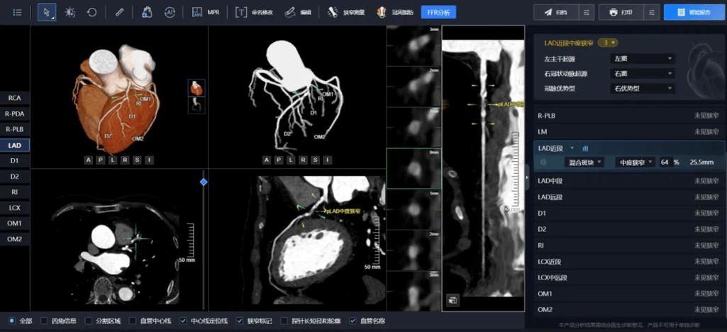 人工智能 医学影像诊断-第2张图片-广州国自机器人