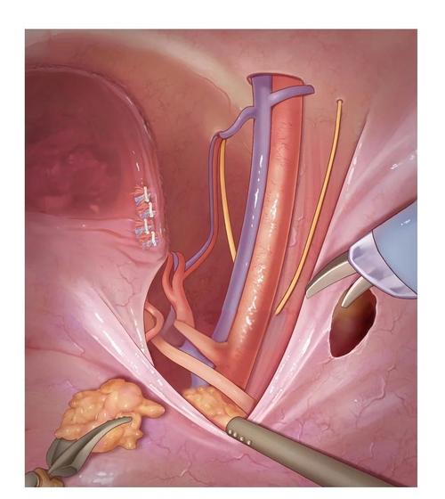 达芬奇机器人 视频教程-第3张图片-广州国自机器人