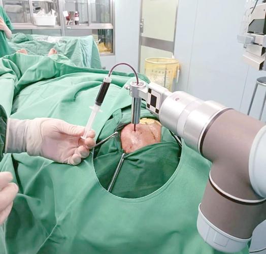 机器人做手术安全吗？-第3张图片-广州国自机器人