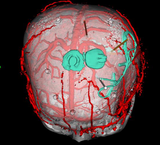 纳米机器人植入大脑会改变人类思维吗？-第2张图片-广州国自机器人
