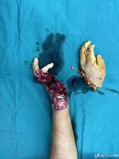 无人机叶割伤人,危险何在?-第1张图片-广州国自机器人 无人机叶割伤人,危险何在?-第1张图片-广州国自机器人