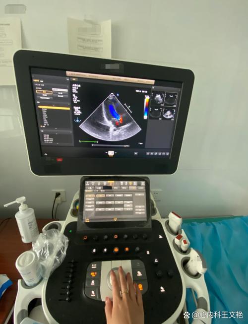 人工智能 超声波影像-第1张图片-广州国自机器人
