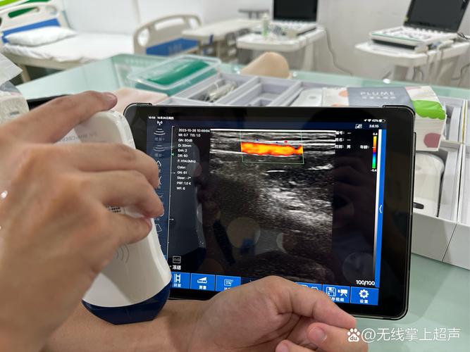 人工智能 超声波影像-第2张图片-广州国自机器人