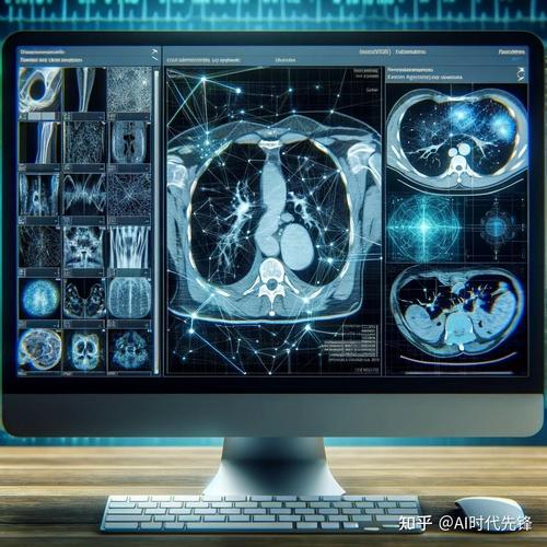 AI如何赋能低剂量CT更精准？-第2张图片-广州国自机器人